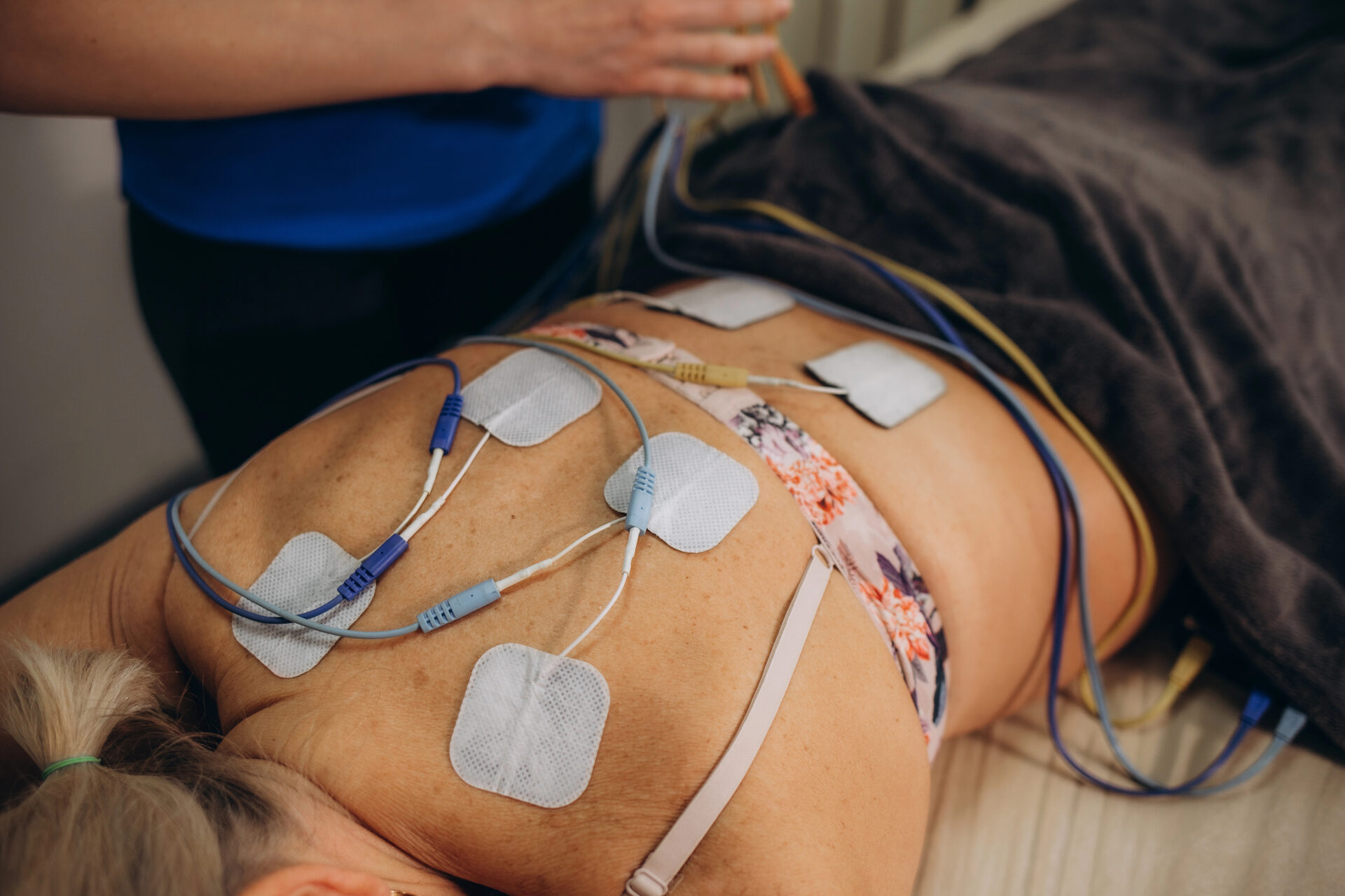 Peripheral nerve stimulation electrode placement