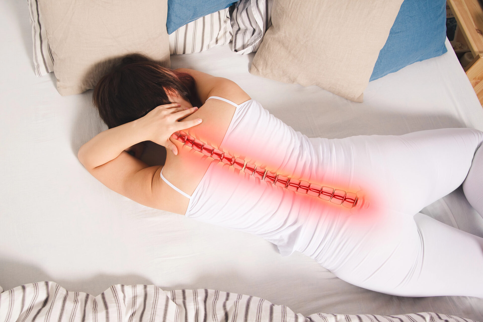 Degenerative Disc Disease illustration
