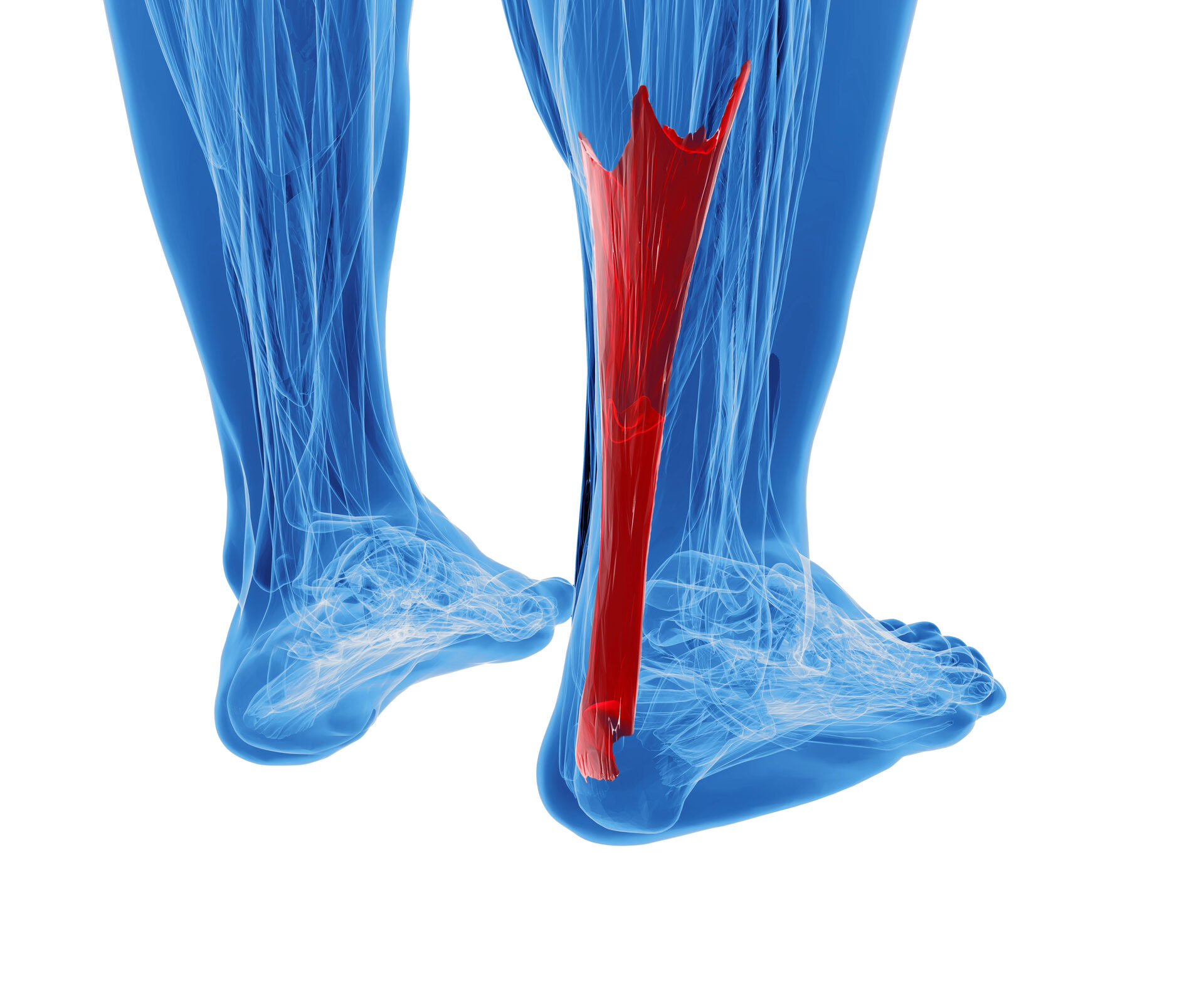 Tendon Injuries & Tendinopathy illustration