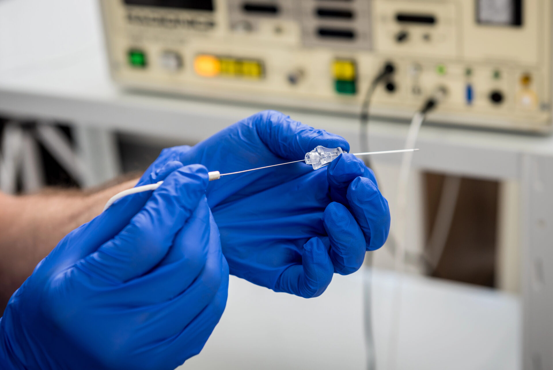 Radiofrequency ablation catheter procedure