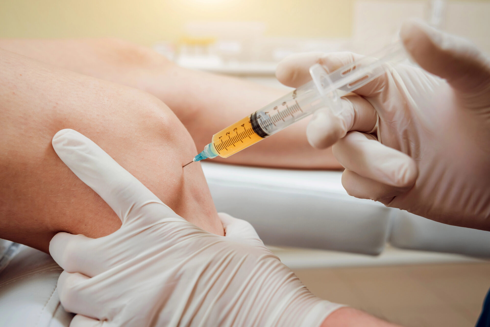 Platelet-rich plasma injection into the knee joint